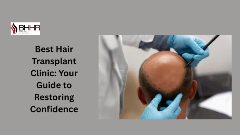 best hair transplant clinic