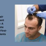 best hair transplant doctor