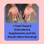 I Tried These 5 Scleroderma Supplements
