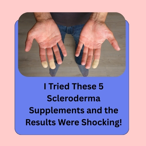 I Tried These 5 Scleroderma Supplements